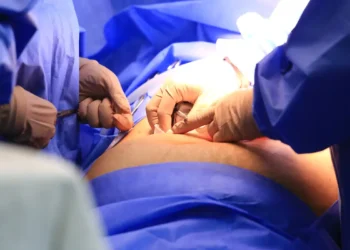 Cinco estados podem zerar fila de cirurgias no SUS