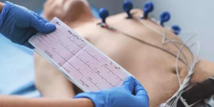 Unidades de Referência realizaram desde maio de 2023 mais de 4.500 eletrocardiogramas