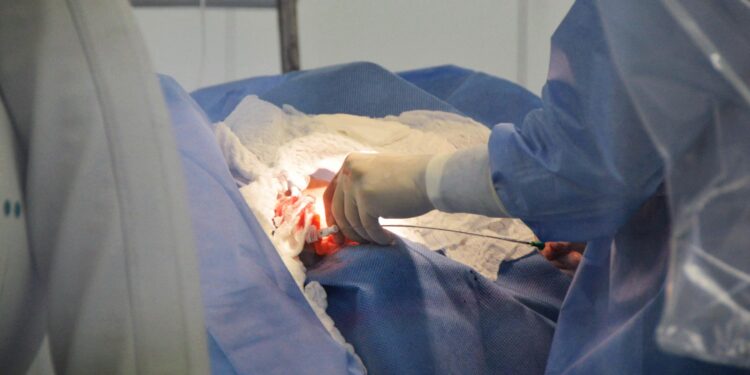 Alagoas realiza mais um transplante de fígado e receptor apresenta boa recuperação